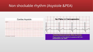 Non shockable rhythm (Asystole &PEA)
 