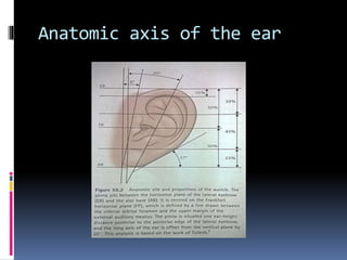 Ears Assymetry Defect based reconstruction of ear | PPTX