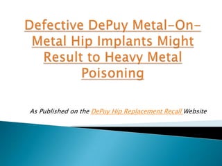 As Published on the DePuy Hip Replacement Recall Website
 