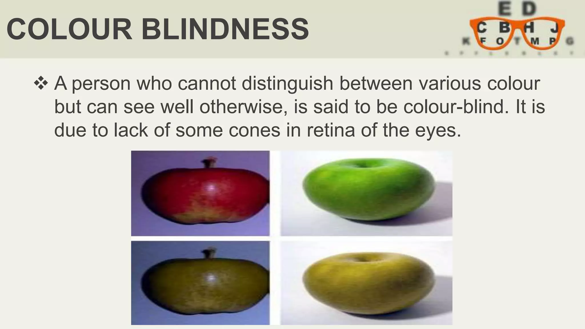 COLOUR BLINDNESS
 A person who cannot distinguish between various colour
but can see well otherwise, is said to be colour-blind. It is
due to lack of some cones in retina of the eyes.
 