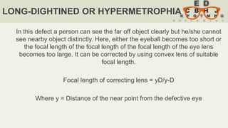 Defect of vision | PPTX