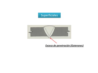 Superficiales 
Exceso de penetración (Goterones) 
 
