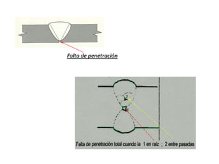 Falta de penetración 
 