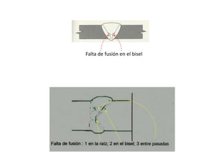 Falta de fusión en el bisel 
 