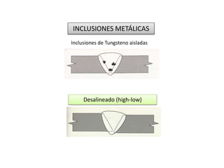 INCLUSIONES METÁLICAS 
Inclusiones de Tungsteno aisladas 
Desalineado (high-low) 
 