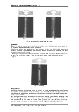 Capítulo III Discontinuidades de Proceso
Ing. R. Echevarria – Lab. E.N.D. – F.I. – Univ. Nac. Comahue
40
a) b)
Fig. 52: Socavaduras o mordeduras de bordes.
Quemado:
Es una zona de la pasada de raíz donde la penetración excesiva ha causado que el aporte de
la soldadura penetre dentro de la misma soplándose.
Resulta de factores que producen un calor excesivo en un área determinada tales como
excesiva corriente, velocidad lenta del electrodo, manejo incorrecto del electrodo, etc. Hay
destrucción completa de biseles.
La imagen radiográfica muestra una densidad localizada más oscura con bordes borrosos en
el centro del ancho de la imagen. Puede ser más ancha que la imagen del cordón de raíz.
Fig. 53.
Fig. 53: Quemado.
Salpicaduras:
Son imperfecciones consistentes, como su nombre lo indica, en esférulas de metal fundido
depositadas aleatoriamente sobre el cordón y su vecindad. Pueden ser provocadas por
humedad en el revestimiento del electrodo. Generalmente, no tienen importancia respecto a la
calidad de la soldadura.
En la imagen radiográfica, aparecen como manchitas blancas, redondeadas, aisladas o en
colonias. En algunas técnicas de soldadura que emplean electrodos de tungsteno (volframio),
las salpicaduras de este metal se dibujan como circulitos muy claros y nítidos. Entonces,
conviene asegurarse de que se trata , efectivamente, de salpicaduras y no de inclusiones.
 