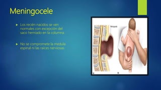 Meningocele
 Los recién nacidos se ven
normales con excepción del
saco herniado en la columna.
 No se compromete la medula
espinal ni las raíces nerviosas.
 