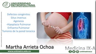 Martha Arrieta Ochoa
Defectos congénitos
Situs inversus
Agenesia
-Hipoplasia Pulmonar
Enfisema Pulmonar
Tumores de la pared toracica
 