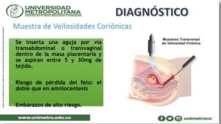 Muestra de Vellosidades Coriónicas
 Se inserta una aguja por vía
transabdominal o transvaginal
dentro de la masa placentaria y
se aspiran entre 5 y 30mg de
tejido.
 Riesgo de pérdida del feto: el
doble que en amniocentesis
 Embarazos de alto riesgo.
 