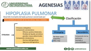 HIPOPLASIA PULMONARDesarrollo incompleto del tejido pulmonar caracterizado por:
de la cantidad y/o tamaño de las vías aéreas, vasos y alvéolos
ETIOLOGIA
-Primaria o idiopática
-Compresión extratorácica
Riñones quístico bilaterales.
Perdida de líquido amniótico
grandes masas abdominales
-Compresión intratorácica
Hernias diafragmáticas
Agenesia diafragmática
Clasificación
Primaria Secundaria
No tiene causa
especifica
Mov. resp
Compresión de los
pulmones
asociada a
comorbilidades
 