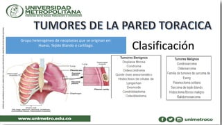 Clasificación
Grupo heterogéneo de neoplasias que se originan en:
Hueso, Tejido Blando o cartílago.
 