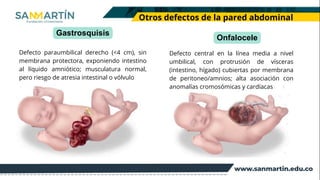 Comprehensive Overview of Abdominal Wall Defects and Hernias: Anatomy ...
