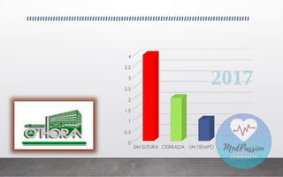 SIN SUTURA CERRADA UN TIEMPO
0
0.5
1
1.5
2
2.5
3
3.5
4
2017
 