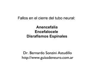Fallos en el cierre del tubo neural:  Anencefalia Encefalocele  Disrafismos Espinales Dr. Bernardo Sonzini Astudillo http://www.guiasdeneuro.com.ar 