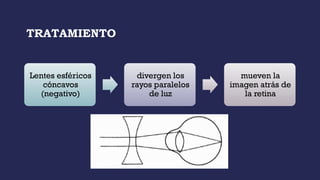 TRATAMIENTO
Lentes esféricos
cóncavos
(negativo)
divergen los
rayos paralelos
de luz
mueven la
imagen atrás de
la retina
 