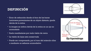 DEFINICIÓN
• Error de refracción donde el foco de los haces
luminosos provenientes de un objeto distante, queda
detrás de la retina
• la imagen se enfoca detrás de la retina en un ojo no
acomodado
• Suele manifestarse por mala visión de cerca
• La visión de lejos esta conservada
• Puede ser compensada, por el tono del músculo ciliar
o mediante un esfuerzo acomodativo
 