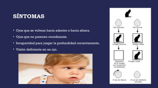 SÍNTOMAS
• Ojos que se voltean hacia adentro o hacia afuera.
• Ojos que no parecen coordinarse.
• Incapacidad para juzgar la profundidad correctamente.
• Visión deficiente en un ojo.
 