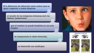 Si la diferencia de refracción entre ambos ojos es
igual o superior a cuatro dioptrías
el tamaño de las imágenes retinianas será tan
distinto (aniseiconia)
que el cerebro no puede fundirlas en una sola
imagen
se compromete la visión binocular,
se desarrolle una ambliopía.
 