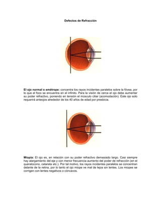 Defectos de Refracción
El ojo normal o emétrope: concentra los rayos incidentes paralelos sobre la fóvea, por
lo que el foco se encuentra en el infinito. Para la visión de cerca el ojo debe aumentar
su poder refractivo, poniendo en tensión el músculo ciliar (acomodación). Este ojo solo
requerirá anteojos alrededor de los 40 años de edad por presbicia.
Miopía: El ojo es, en relación con su poder refractivo demasiado largo. Casi siempre
hay alargamiento del eje y con menor frecuencia aumento del poder de refracción (en el
queratocono, catarata etc.). Por tal motivo, los rayos incidentes paralelos se concentran
delante de la retina, por lo tanto el ojo miope ve mal de lejos sin lentes. Los miopes se
corrigen con lentes negativos o cóncavos.
 