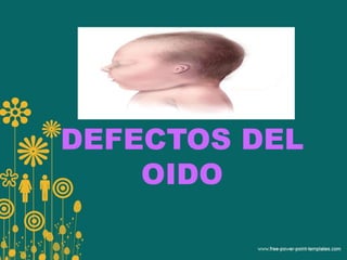DEFECTOS DEL
OIDO
 