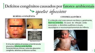 MELHOR para você
E M P R E S A D E O R G Â N I C O S
Defeitoscongênitoscausadospor fatoresambientais
9
CITOMEGALOVÍRUS
É a infecção viral mais comum nos fetos e, geralmente,
fatal nos embriões. Os casos de infecção estão
associados a distúrbios auditivos e visuais,
neurológicos e neurocomportamentais da infância.
O vírus da rubéola atravessa a membranada
placenta e infectao embrião/feto.
Característicasclínicas: catarata,glaucoma
congênito, defeitoscardíacose surdez.
agentes infecciosos
 