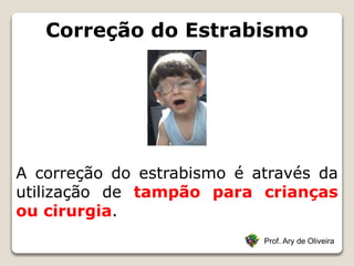 Correção do Estrabismo
Prof. Ary de Oliveira
A correção do estrabismo é através da
utilização de tampão para crianças
ou cirurgia.
 