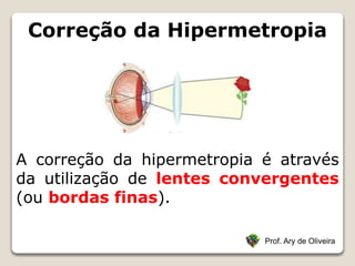 Correção da Hipermetropia
Prof. Ary de Oliveira
A correção da hipermetropia é através
da utilização de lentes convergentes
(ou bordas finas).
 