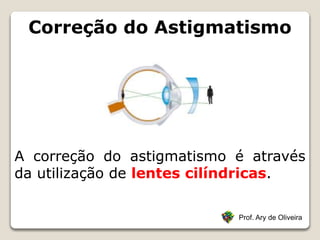 Correção do Astigmatismo
Prof. Ary de Oliveira
A correção do astigmatismo é através
da utilização de lentes cilíndricas.
 