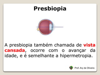 Presbiopia
Prof. Ary de Oliveira
A presbiopia também chamada de vista
cansada, ocorre com o avançar da
idade, e é semelhante a hipermetropia.
 