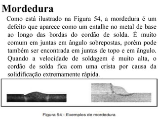 Mordedura
Como está ilustrado na Figura 54, a mordedura é um
defeito que aparece como um entalhe no metal de base
ao longo das bordas do cordão de solda. É muito
comum em juntas em ângulo sobrepostas, porém pode
também ser encontrada em juntas de topo e em ângulo.
Quando a velocidade de soldagem é muito alta, o
cordão de solda fica com uma crista por causa da
solidificação extremamente rápida.
 