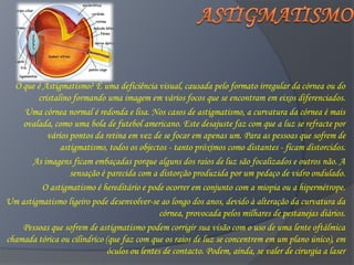 O que é Astigmatismo? É uma deficiência visual, causada pelo formato irregular da córnea ou do
        cristalino formando uma imagem em vários focos que se encontram em eixos diferenciados.
    Uma córnea normal é redonda e lisa. Nos casos de astigmatismo, a curvatura da córnea é mais
    ovalada, como uma bola de futebol americano. Este desajuste faz com que a luz se refracte por
           vários pontos da retina em vez de se focar em apenas um. Para as pessoas que sofrem de
               astigmatismo, todos os objectos - tanto próximos como distantes - ficam distorcidos.
       As imagens ficam embaçadas porque alguns dos raios de luz são focalizados e outros não. A
                  sensação é parecida com a distorção produzida por um pedaço de vidro ondulado.
          O astigmatismo é hereditário e pode ocorrer em conjunto com a miopia ou a hipermétrope.
Um astigmatismo ligeiro pode desenvolver-se ao longo dos anos, devido à alteração da curvatura da
                                              córnea, provocada pelos milhares de pestanejas diários.
    Pessoas que sofrem de astigmatismo podem corrigir sua visão com o uso de uma lente oftálmica
chamada tórica ou cilíndrico (que faz com que os raios de luz se concentrem em um plano único), em
                              óculos ou lentes de contacto. Podem, ainda, se valer de cirurgia a laser
 
