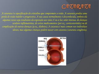 A catarata é a opacificação do cristalino que compromete a visão. A catarata produz uma
perda de visão indolor e progressiva. A sua causa normalmente é desconhecida, embora ela
 algumas vezes seja resultante da exposição aos raios X ou à luz solar intensa, de doenças
            oculares inflamatórias, de certos medicamentos (por ex., corticosteróides) ou de
complicações de outras doenças (p.ex., diabetes). A catarata é mais comum nos indivíduos
            idosos, mas algumas crianças podem nascer com catarata (catarata congênita).
 