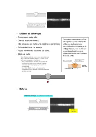  Excesso de penetração
- Amperagem muito alta;
- Grande abertura da raiz;
- Não utilização de mata-junta (cobre ou cerâmico);
- Baixa velocidade de avanço;
- Pouco movimento oscilante da tocha.
- Stick out curto.
 Reforço
Eventualmente podemosutilizar
um suporte naparte inferiorda
solda,que ajudaa conter o
material fundidonaoperaçãode
soldageme que pode ounão ser
removidoapósotérminoda
solda,chamadode mata-juntaou
de cobre-junta.
 