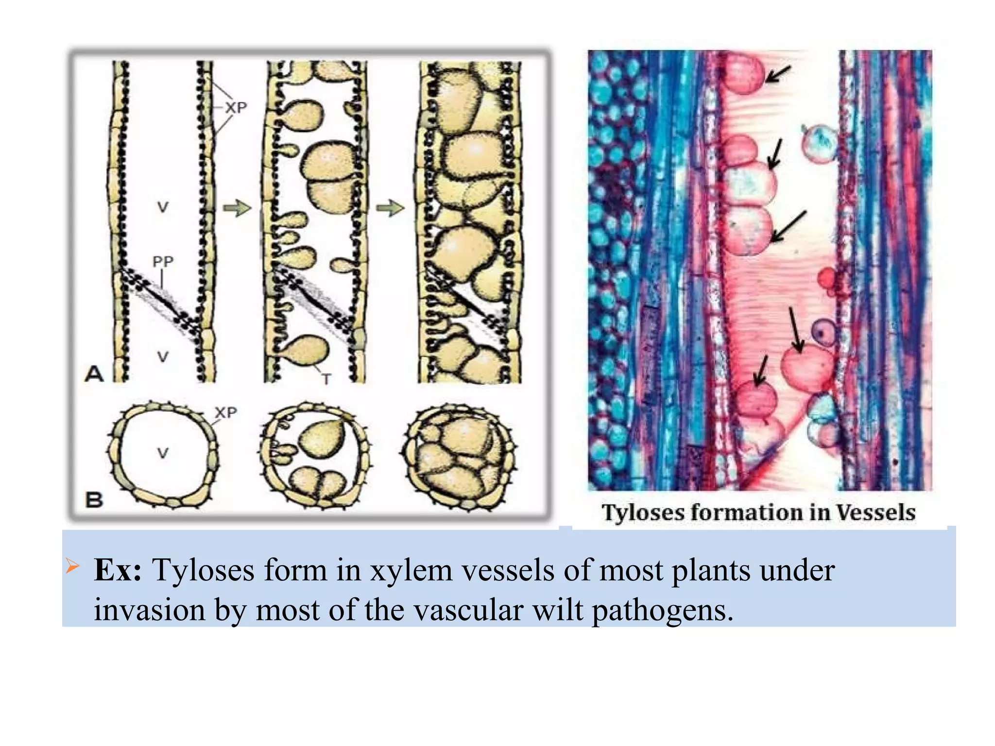  Ex: Tyloses form in xylem vessels of most plants under
invasion by most of the vascular wilt pathogens.
 