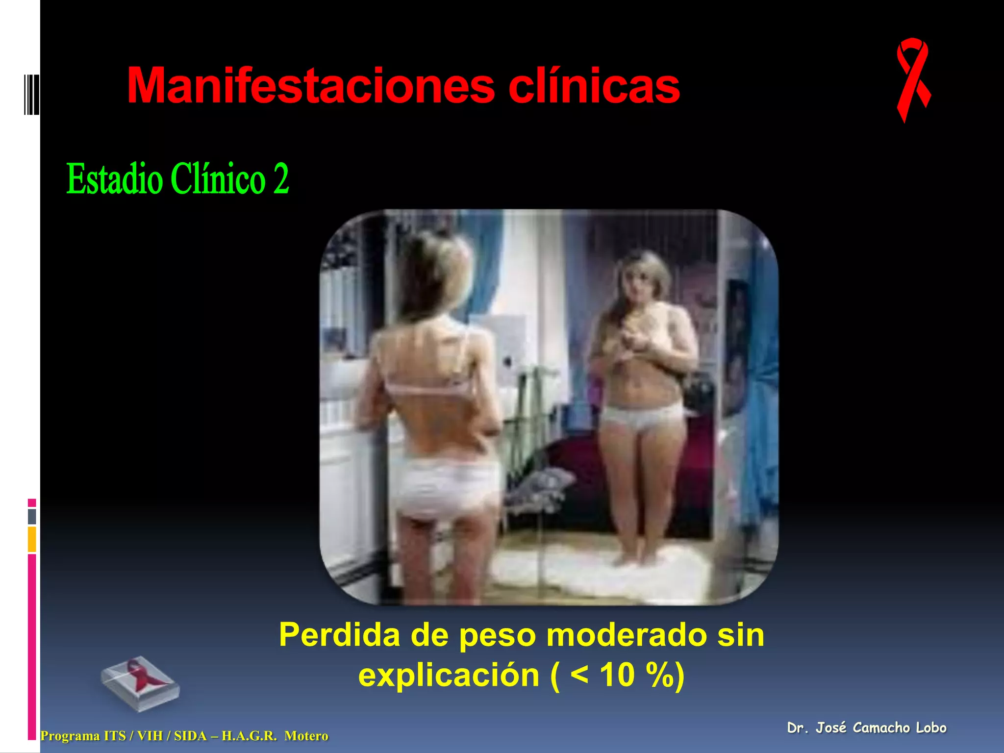 Manifestaciones clínicas




                                   Perdida de peso moderado sin
                                        explicación ( < 10 %)
                                                                  Dr. José Camacho Lobo
Programa ITS / VIH / SIDA – H.A.G.R. Motero
 