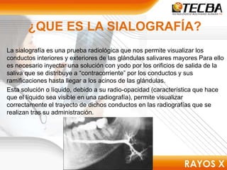 ¿QUE ES LA SIALOGRAFÍA?
La sialografía es una prueba radiológica que nos permite visualizar los
conductos interiores y exteriores de las glándulas salivares mayores Para ello
es necesario inyectar una solución con yodo por los orificios de salida de la
saliva que se distribuye a “contracorriente” por los conductos y sus
ramificaciones hasta llegar a los acinos de las glándulas.
Esta solución o líquido, debido a su radio-opacidad (característica que hace
que el líquido sea visible en una radiografía), permite visualizar
correctamente el trayecto de dichos conductos en las radiografías que se
realizan tras su administración.
 