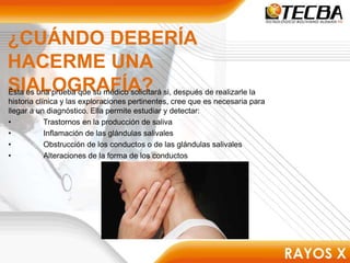 ¿CUÁNDO DEBERÍA
HACERME UNA
SIALOGRAFÍA?
Ésta es una prueba que su médico solicitará si, después de realizarle la
historia clínica y las exploraciones pertinentes, cree que es necesaria para
llegar a un diagnóstico. Ella permite estudiar y detectar:
• Trastornos en la producción de saliva
• Inflamación de las glándulas salivales
• Obstrucción de los conductos o de las glándulas salivales
• Alteraciones de la forma de los conductos
 