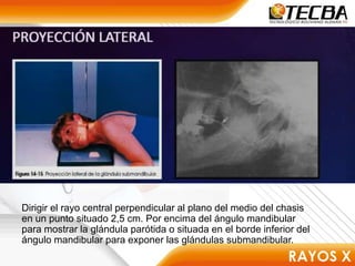 Dirigir el rayo central perpendicular al plano del medio del chasis
en un punto situado 2,5 cm. Por encima del ángulo mandibular
para mostrar la glándula parótida o situada en el borde inferior del
ángulo mandibular para exponer las glándulas submandibular.
 