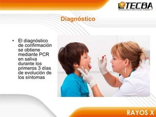 Diagnóstico
• El diagnóstico
de confirmación
se obtiene
mediante PCR
en saliva
durante los
primeros 3 días
de evolución de
los síntomas
 