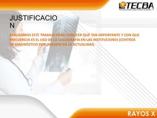 REALIZAMOS ESTE TRABAJO PARA CONOCER QUÉ TAN IMPORTANTE Y CON QUE
FRECUENCIA ES EL USO DE LA SIALOGRAFÍA EN LAS INSTITUCIONES (CENTROS
DE DIAGNÓSTICO POR IMAGEN) EN LA ACTUALIDAD.
JUSTIFICACIO
N
 