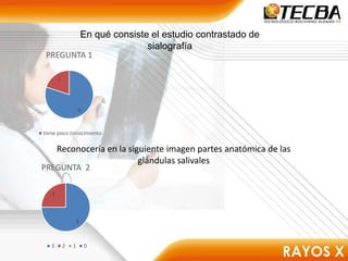 En qué consiste el estudio contrastado de
sialografía
4
1
PREGUNTA 1
tiene poco conocimiento
Reconocería en la siguiente imagen partes anatómica de las
glándulas salivales
3
1
PREGUNTA 2
3 2 1 0
 