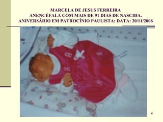 MARCELA DE JESUS FERREIRA ANENCÉFALA COM MAIS DE 91 DIAS DE NASCIDA. ANIVERSÁRIO EM PATROCÍNIO PAULISTA: DATA: 20/11/2006 