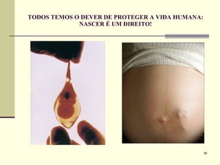 TODOS TEMOS O DEVER DE PROTEGER A VIDA HUMANA: NASCER É UM DIREITO! 