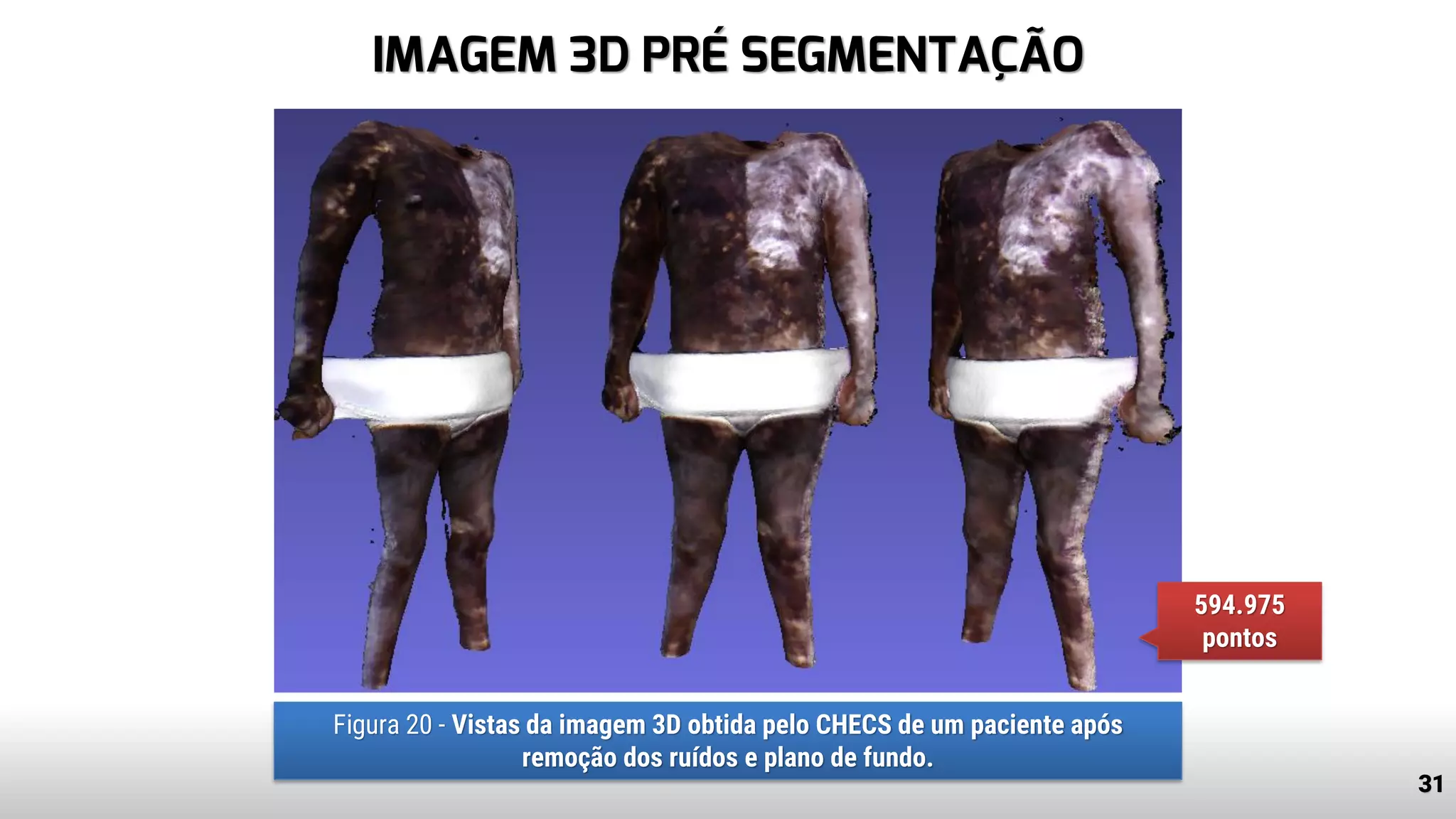 IMAGEM 3D PRÉ SEGMENTAÇÃO
31
Figura 20 - Vistas da imagem 3D obtida pelo CHECS de um paciente após
remoção dos ruídos e plano de fundo.
594.975
pontos
 