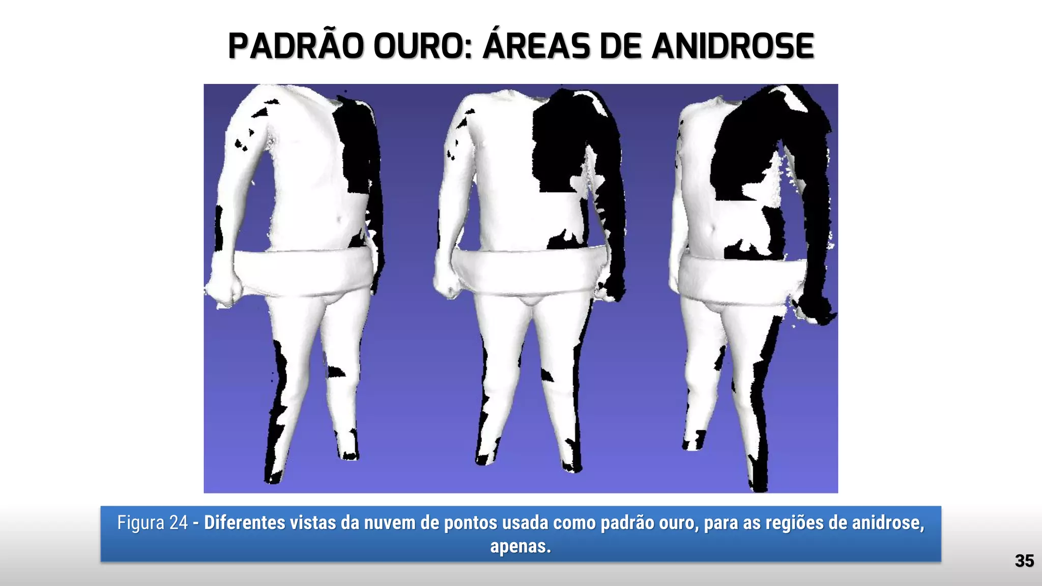 PADRÃO OURO: ÁREAS DE ANIDROSE
35
Figura 24 - Diferentes vistas da nuvem de pontos usada como padrão ouro, para as regiões de anidrose,
apenas.
 