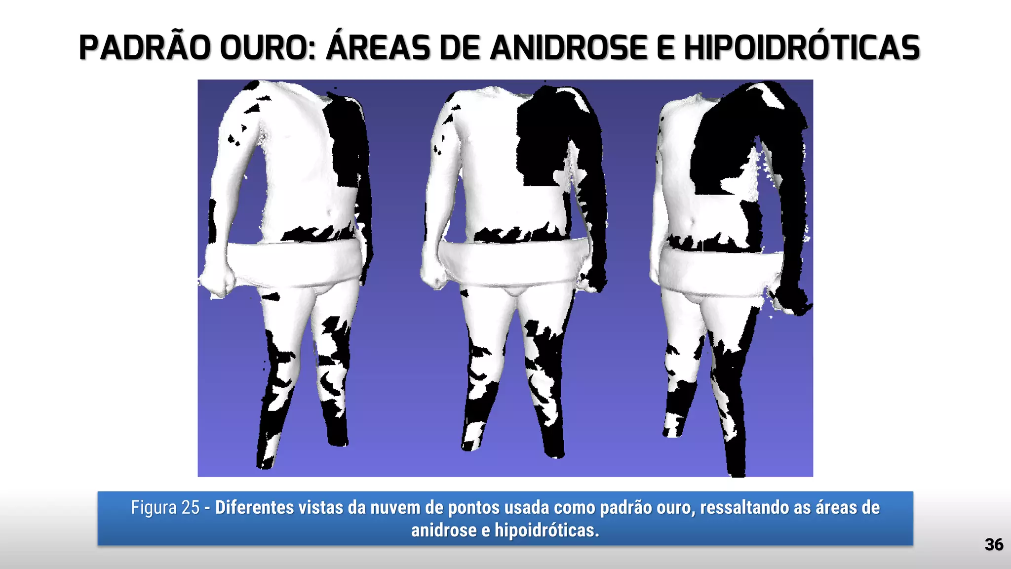 PADRÃO OURO: ÁREAS DE ANIDROSE E HIPOIDRÓTICAS
36
Figura 25 - Diferentes vistas da nuvem de pontos usada como padrão ouro, ressaltando as áreas de
anidrose e hipoidróticas.
 