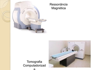 Ressonância
                  Magnética




  Tomografia
Computadorizad
 