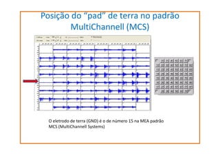 Posição do “pad” de terra no padrão
MultiChannell (MCS)

fr

O eletrodo de terra (GND) é o de número 15 na MEA padrão
MCS (MultiChannell Systems)

 