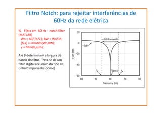 Filtro Notch: para rejeitar interferências de
60Hz da rede elétrica
% Filtra em 60 Hz - notch filter
(MATLAB)
Wo = 60/(Fs/2); BW = Wo/35;
[b,a] = iirnotch(Wo,BW);
y = filter(b,a,m);
A e B determinam a largura de
banda do filtro. Trata-se de um
filtro digital recursivo do tipo IIR
(Infinit Impulse Response)

 