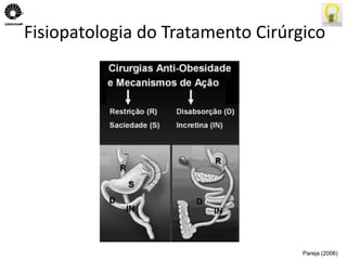 Fisiopatologia do Tratamento Cirúrgico 
Pareja (2006) 
 